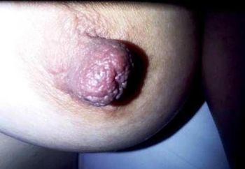 Big Nipple - for big nipple lover - vinaangelica - Amateur Porn - Free ...
